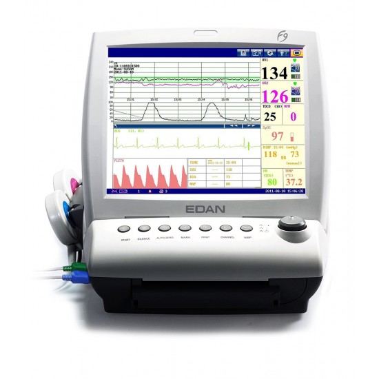 Express Fetal Monitor F9 Express Fetal Monitor F9
