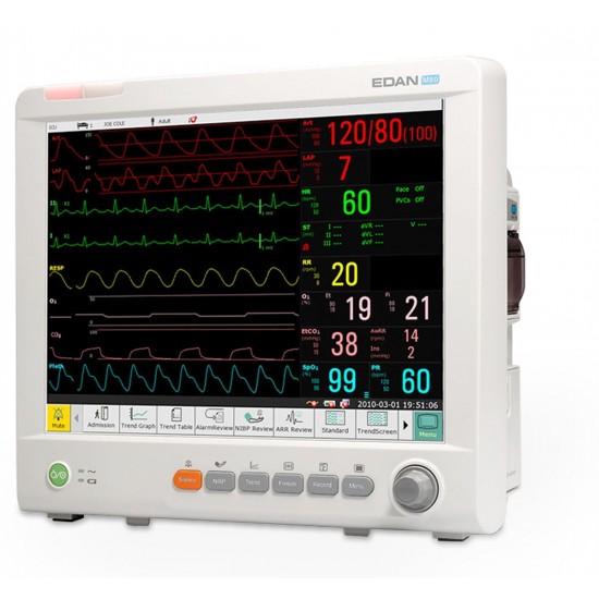 Patient Monitor IM80 Patient Monitor IM80