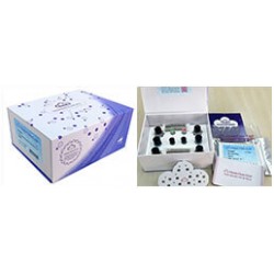 ELISA for Acetylcholinesterase (ACHE) GE 96T ELISA for Acetylcholinesterase (ACHE) GE 96T