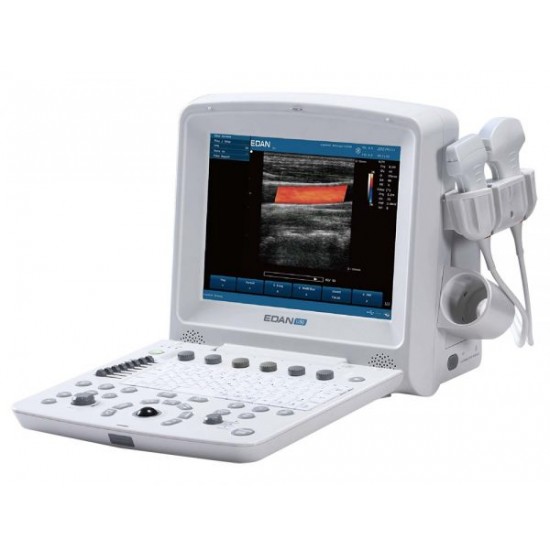 Portable U50 Prime Diagnostic Ultrasound System Portable U50 Prime Diagnostic Ultrasound System
