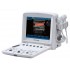 Portable U50 Prime Diagnostic Ultrasound System with two probe