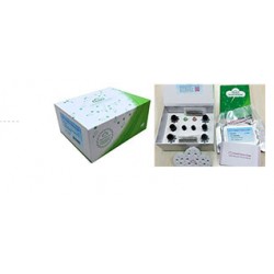 ELISA Kit for Carnitine Acetyltransferase (CRAT) 96 T ELISA Kit for Carnitine Acetyltransferase (CRAT) 96 T