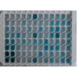ELISA Kit for Follicle Stimulating Hormone (FSH) 96 Test ELISA Kit for Follicle Stimulating Hormone (FSH) 96 Test