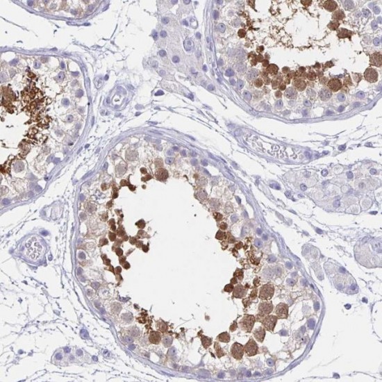 Anti-HSPA4L antibody produced in rabbit , 100 μL