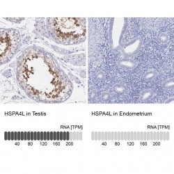 Anti-HSPA4L antibody produced in rabbit , 100 μL Anti-HSPA4L antibody produced in rabbit , 100 μL