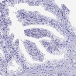 Anti-HSPA1L antibody produced in rabbit ,25UL Anti-HSPA1L antibody produced in rabbit ,25UL