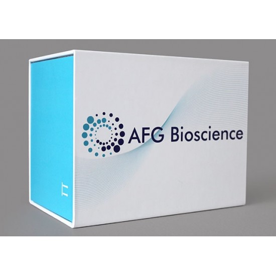 Mouse hepatitis B virus core antibody,HBcAb Elisa Kit, 1x96 well plate Mouse hepatitis B virus core antibody,HBcAb Elisa Kit, 1x96 well plate