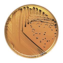 Salmonella Shigella Agar Plat Salmonella Shigella Agar Plat