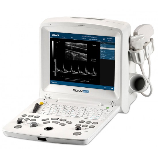 Digital Diagnostic Ultrasound system Digital Diagnostic Ultrasound system