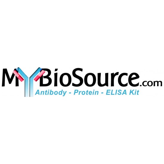 Camel Estradiol 17-Beta-Dehydrogenase 2 (HSD17B2) ELISA Kit Camel Estradiol 17-Beta-Dehydrogenase 2 (HSD17B2) ELISA Kit