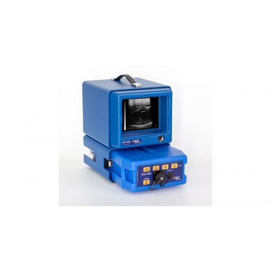 Portable ultrasound with unique 170° sector image for scanning foetal numbers in sheep